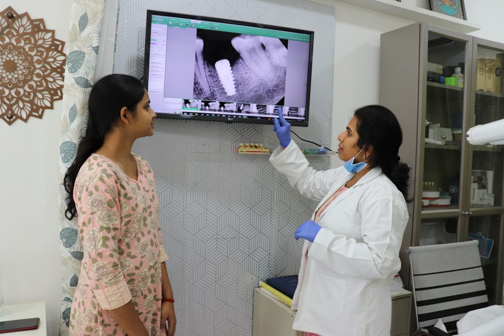 SHOWING X-RAY