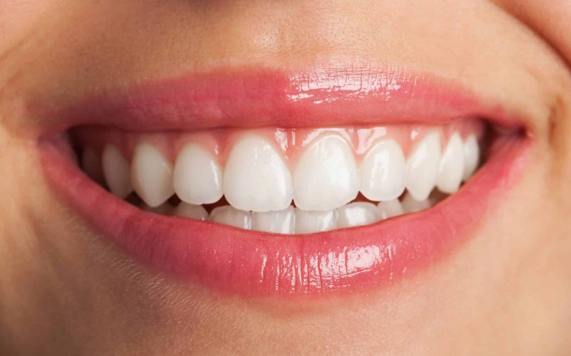 best dental