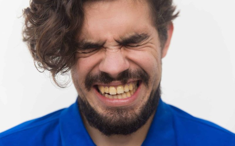 Bad teeth